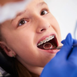 The Importance Of Regular Visits To The Pediatric Dentist